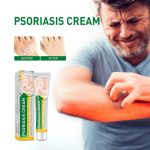 Skin Tinea Care External Cream - كريم لعلاج الصدفية والأكزيما بالأعشاب الطبيعية - 👩 العناية بالمرأة