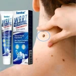 image of applying the cream - كريم لإزالة الثآليل