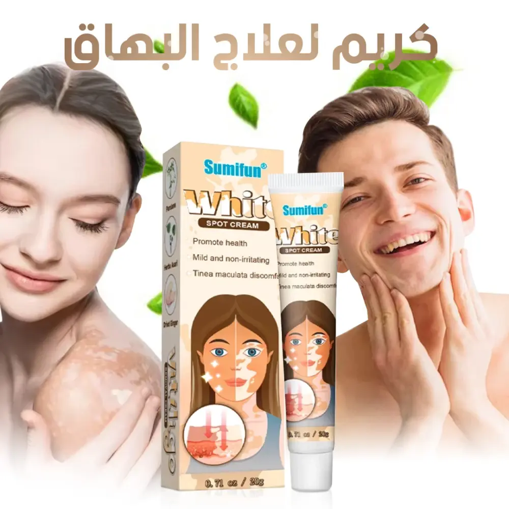 gallery_image_1 - كريم لعلاج البهاق