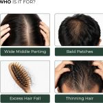 gallery_image_3 - بخاخ نيو هير لعلاج تساقط الشعر